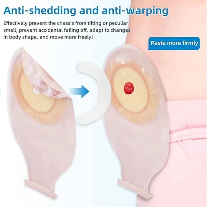 Medical Tape - Pita Penguat Kantong Ostomi Medis, Pita
